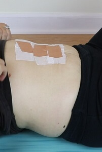 paper tape and leukotape to temporarily patch a hernia